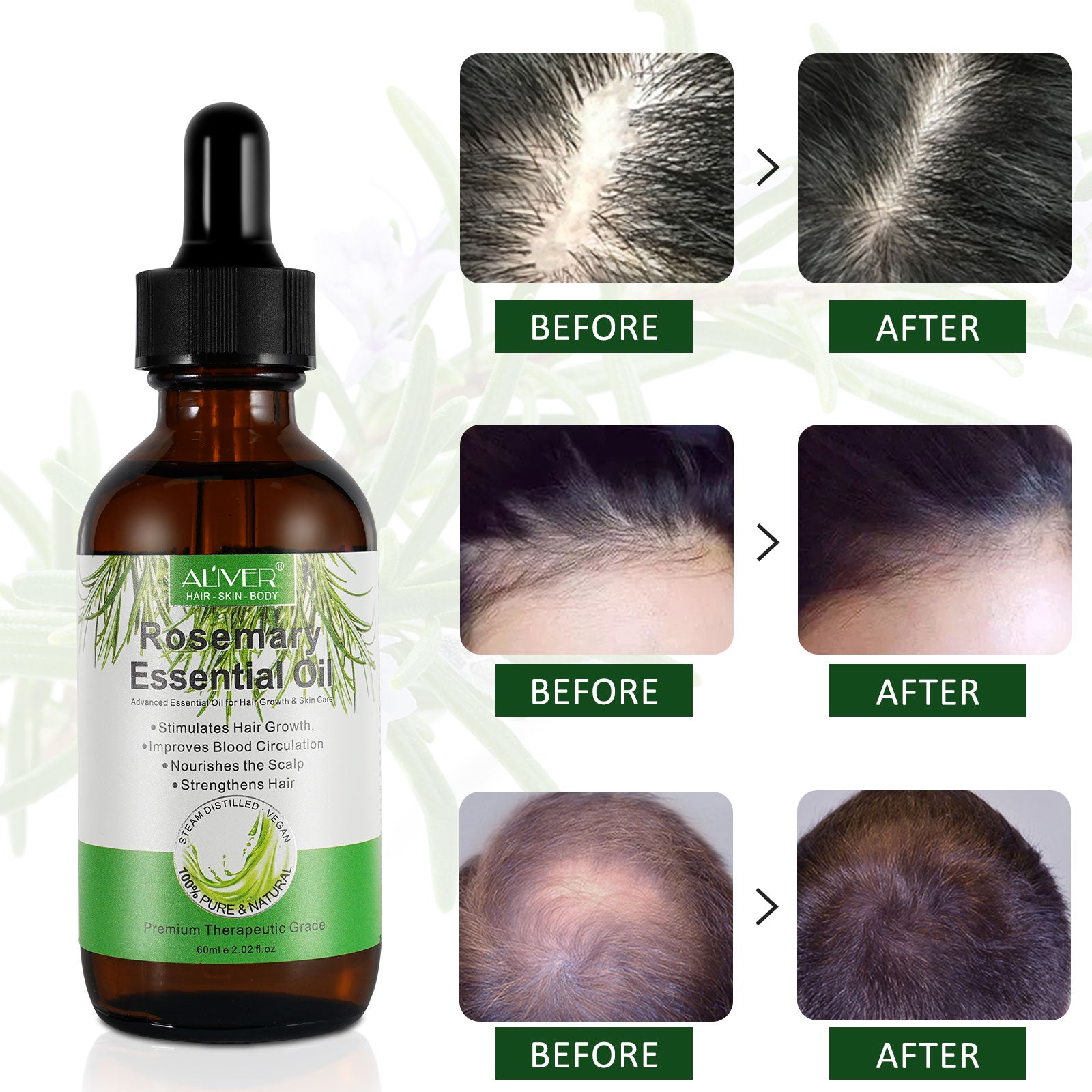 Aliver Rosemary Oil for Hair Growth – Aliver Beauty|Aliver.com