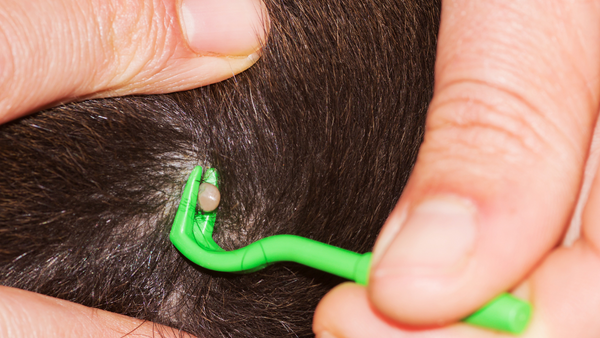 Removing Cat Tick with Fine Point Tweezers