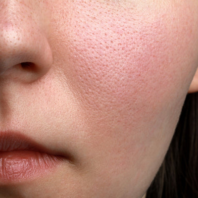HOW CAN PORES BE TIGHTENED FOR CLEARER SKIN?