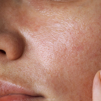 Laboratoires FILORGA recommends a skincare routine designed to combat oily skin.