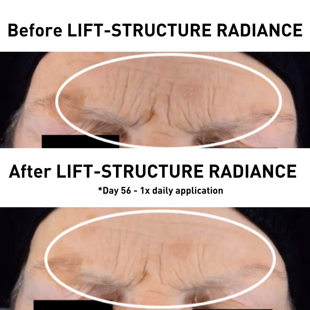 LIFT-STRUCTURE RADIANCE