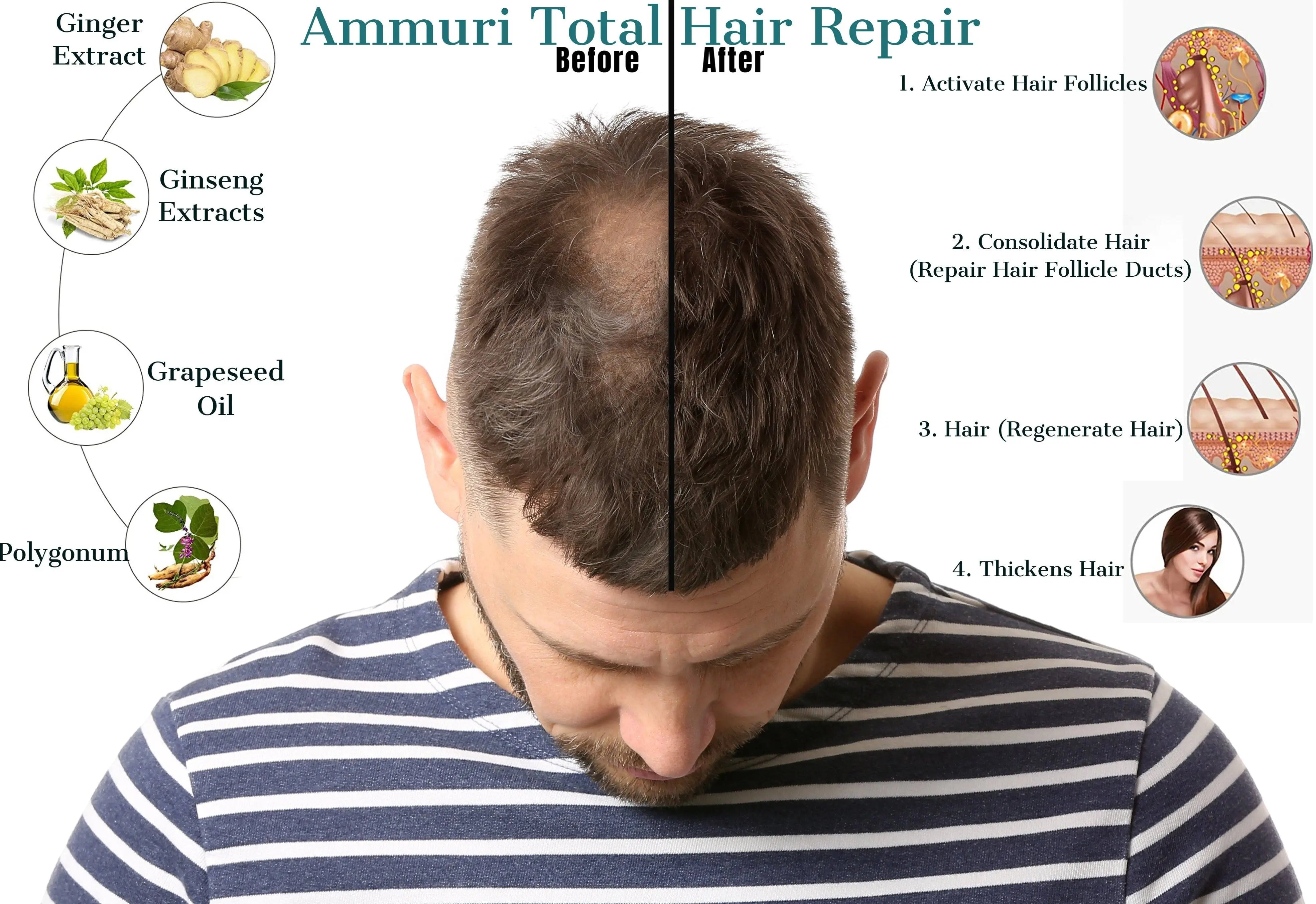 Ammuri-Skincare - Ammuri Anti Hair Loss Hair Serum for Hair Thinning  Balding Repair Hair Follicles Great for Slow-Growing Hair - Hair Growth  Problems for Men and Women – Ammuri Skincare