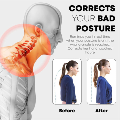 Correct Poor Posture – Functional Patterns