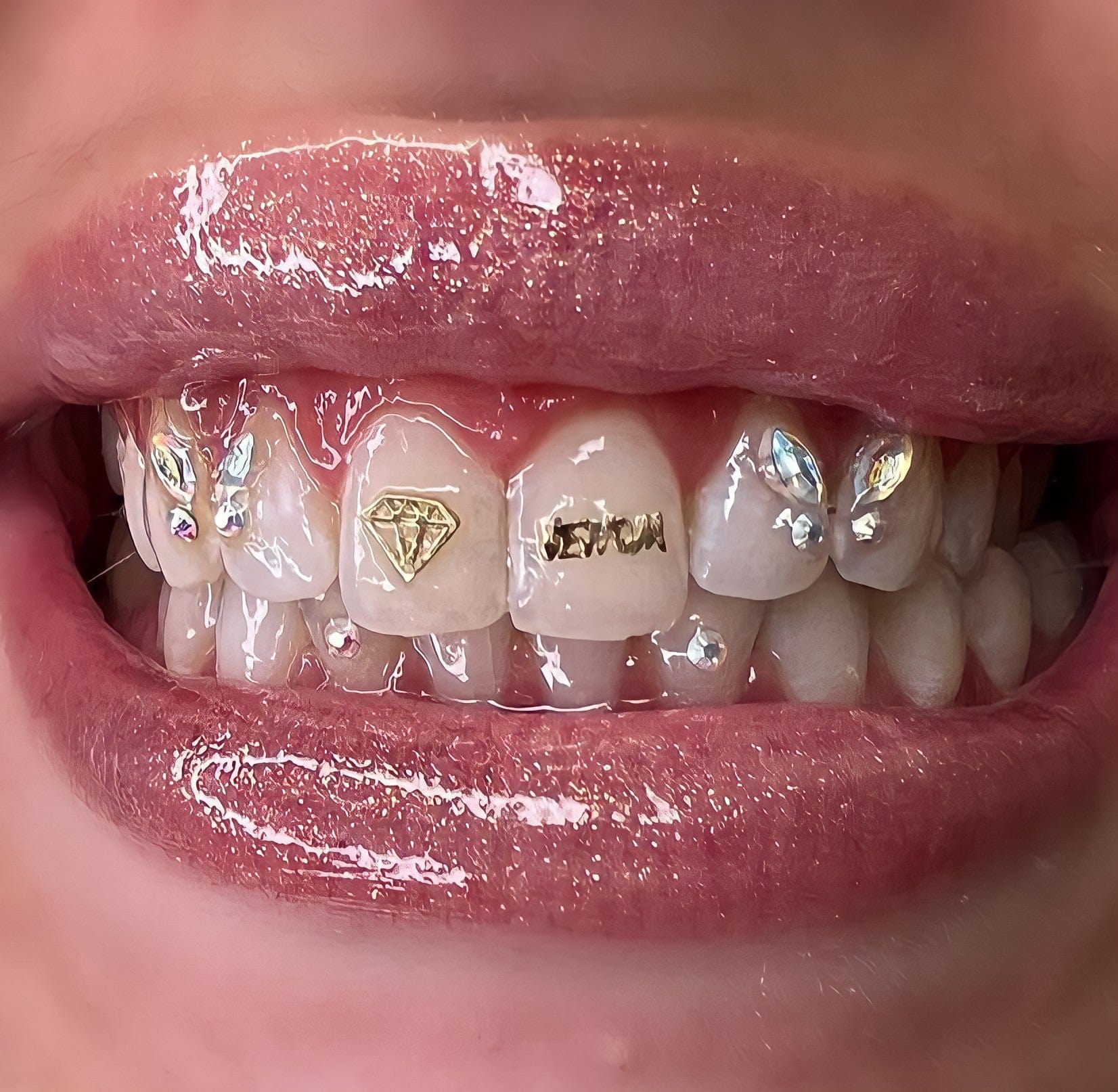 Real Diamond Tooth Gem | tunersread.com