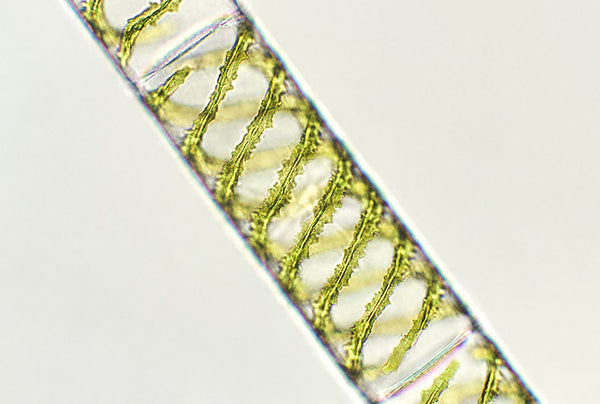 blue green algae under microscp[e
