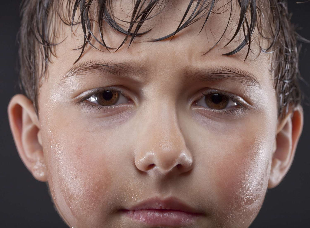 How to treat excessive sweating in children