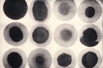 X-ray of badly made golf balls