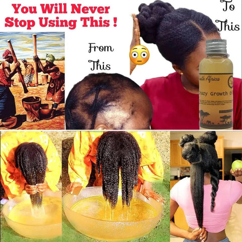 Before and after collage pictures of using an extreme hair growth oil