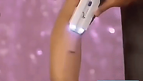Depilador a Laser Elétrico UltraMax - Removedor de pelos
