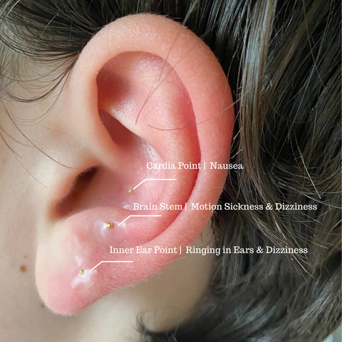How does acupuncture for tinnitus work? - The Acupuncture Clinic