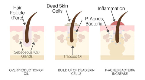 infographic showing effects of hard water on skin