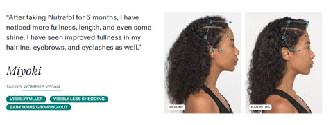 nutrafol for hair growth, image of testimonial for reduced hair loss