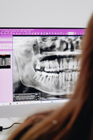 A dental scan displayed on a computer screen