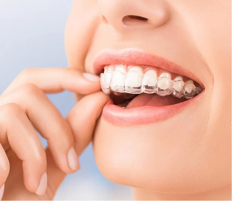 A person putting on a dental guard