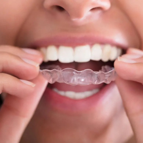A person placing a dental guard in their mouth