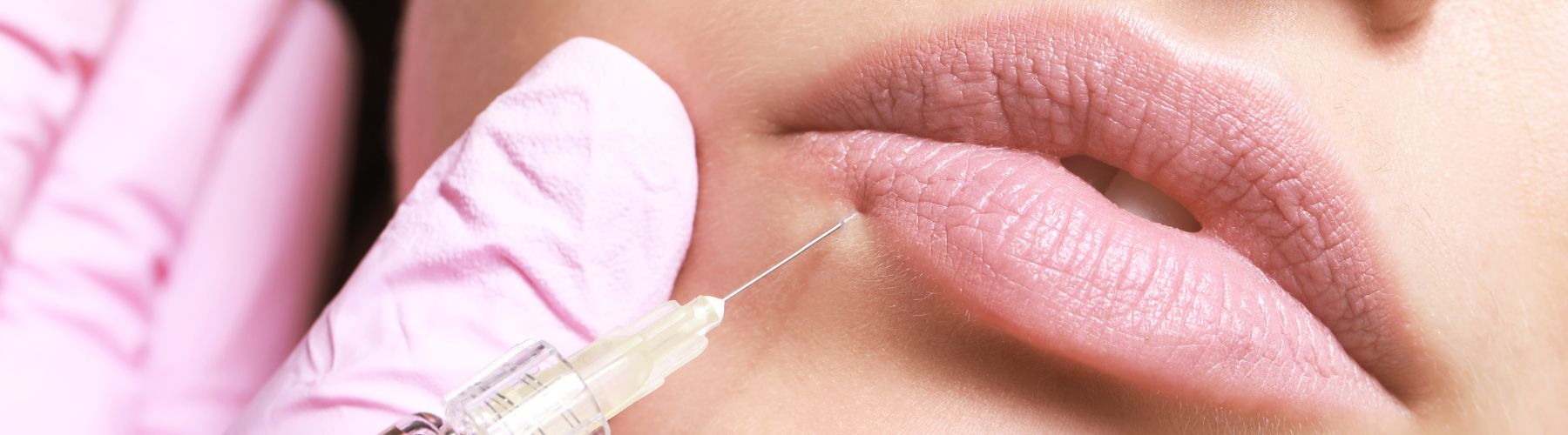 Aesthetic practitioner administering lip filler