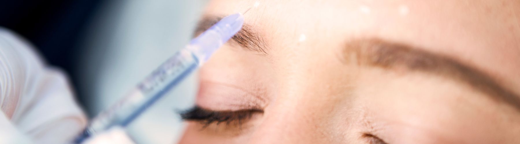 How Often Should You Top Up Botox?