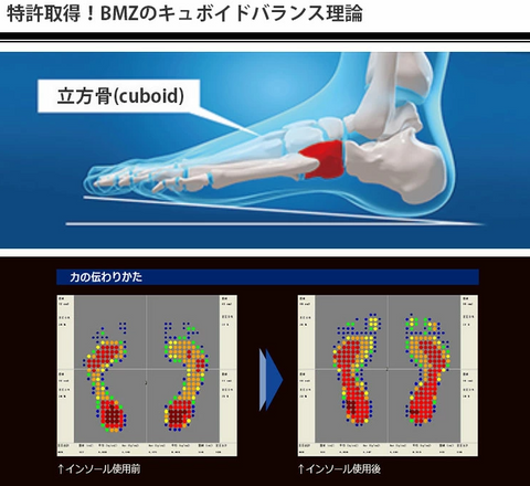 足が速くなった!腰の痛みが和らいだ!?BMZインソール「スタンダード」ウォーキングなどにおすすめ！　特許を取得した立方骨(cuboid)理論