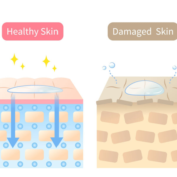 Damaged skin barrier