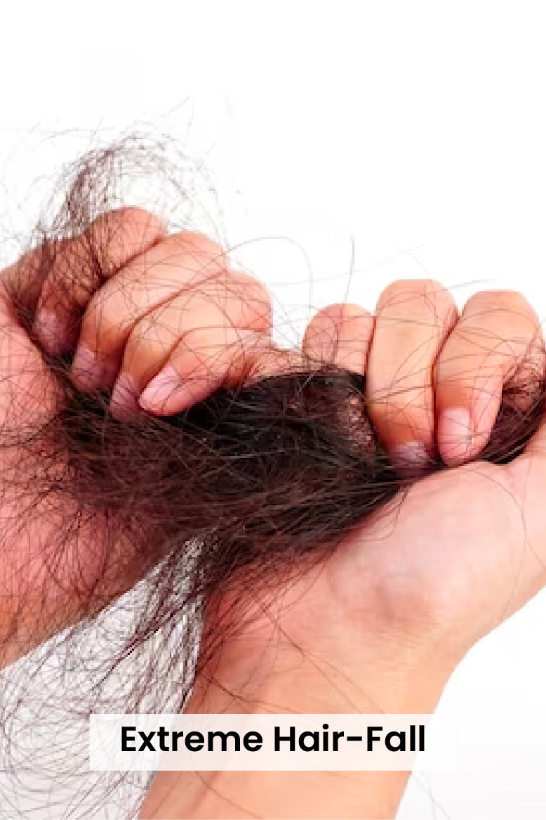 Hair Loss Alopecia Causes Symptoms and Regrowth Options