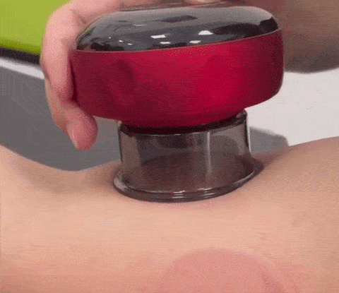 Cupping Therapy Massager | Home 1+1