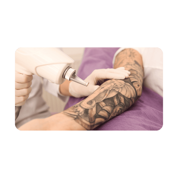 Tattoo Removal Business Plan