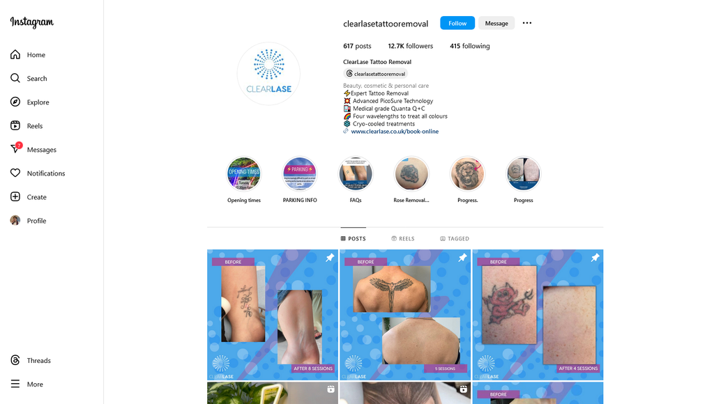 Social Media Strategy for tattoo removal websites 3