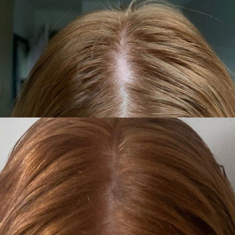 scalp brushing before and after