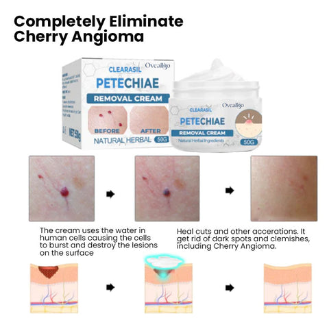 Oveallgo™ Clearasil Petechiae Removal Cream