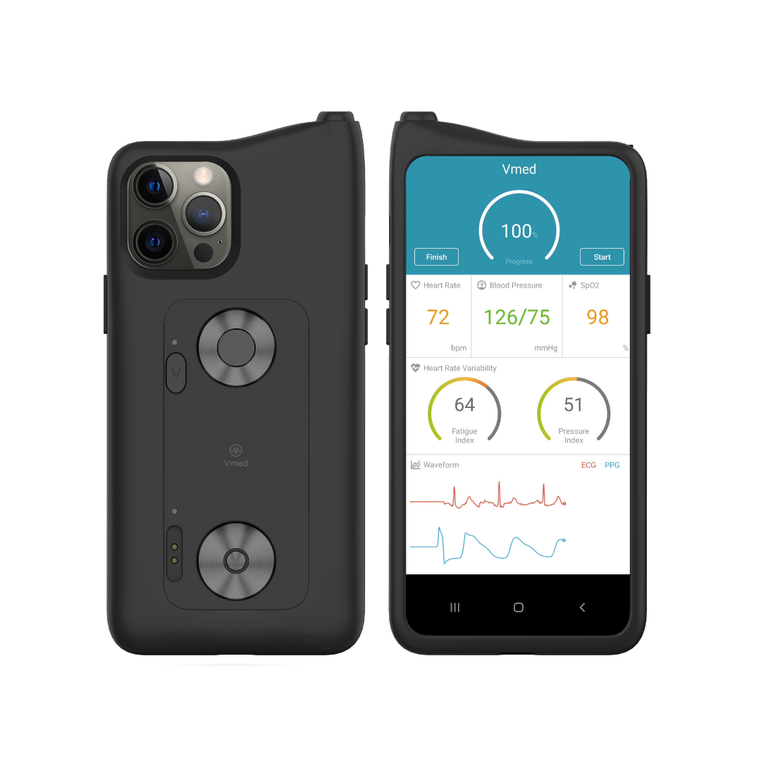 Smartphone Based Health Monitoring