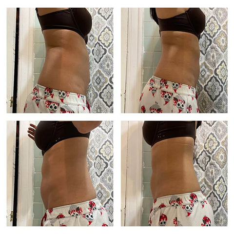 ultrasonic cavitation before and after photos