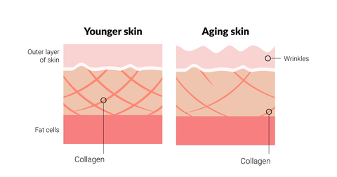 collagen and skin aging