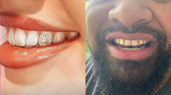 A men and women with gold tooth