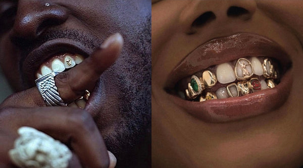 One men and one women with gold tooth