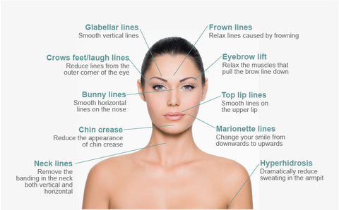 diagram of botox