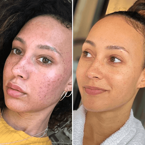 Before & After Lighten Up