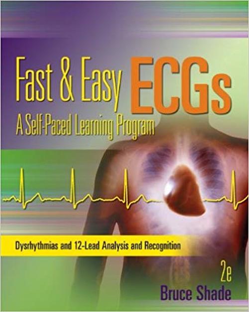 Test Bank Fast and Easy ECGs- A Self-Paced Learning Program 2nd Edition for Success