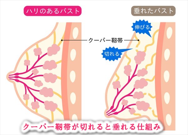 veimiaクーパー靭帯とは