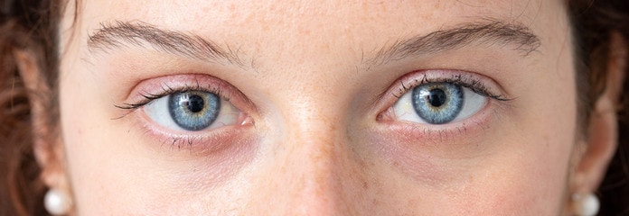 Close up view of a pair of blue eyes