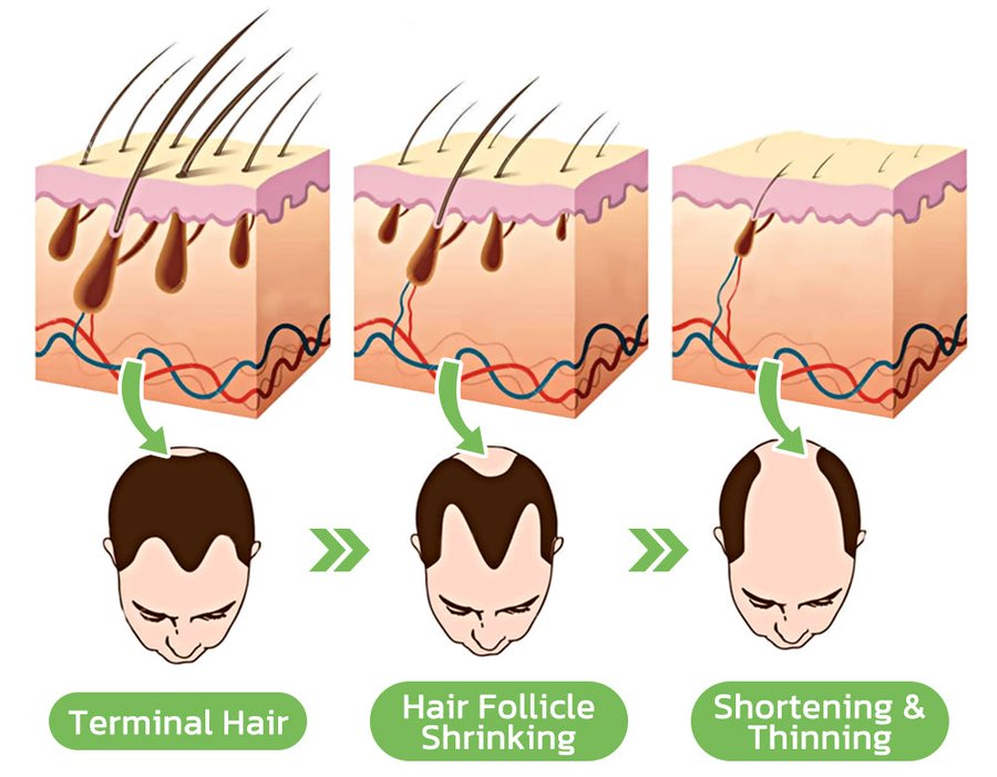 HaarGrowthPlus - Serum forcues për rritjen e flokëve për kujdesin e flokëve - 120 ml Spray Lotion Kujdesi për flokët