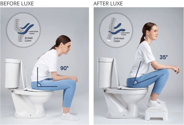 Comparison of a model using the toilet sitting at a 90° angle without a LUXE footstool and a 35° angle with. The puborectalis muscle is shown in both positions and text reads Kinked Colon before LUXE and Unkinked Colon after LUXE