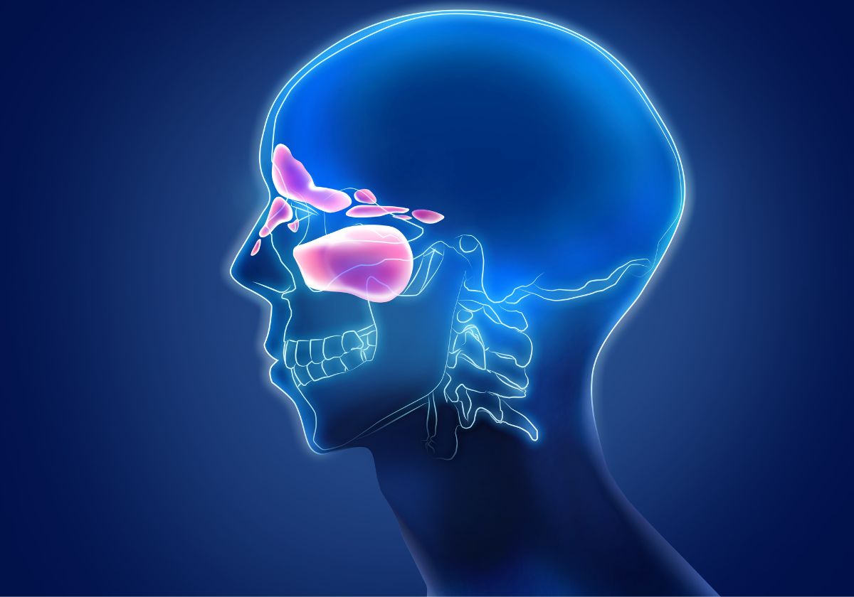 x-ray of sinus infection