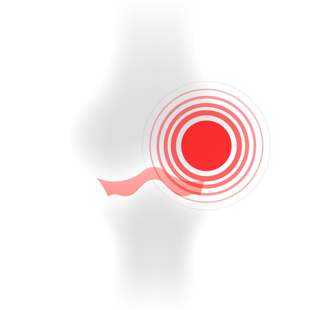 Illustration of a human knee joint with a red circle highlighting pain or inflammation.