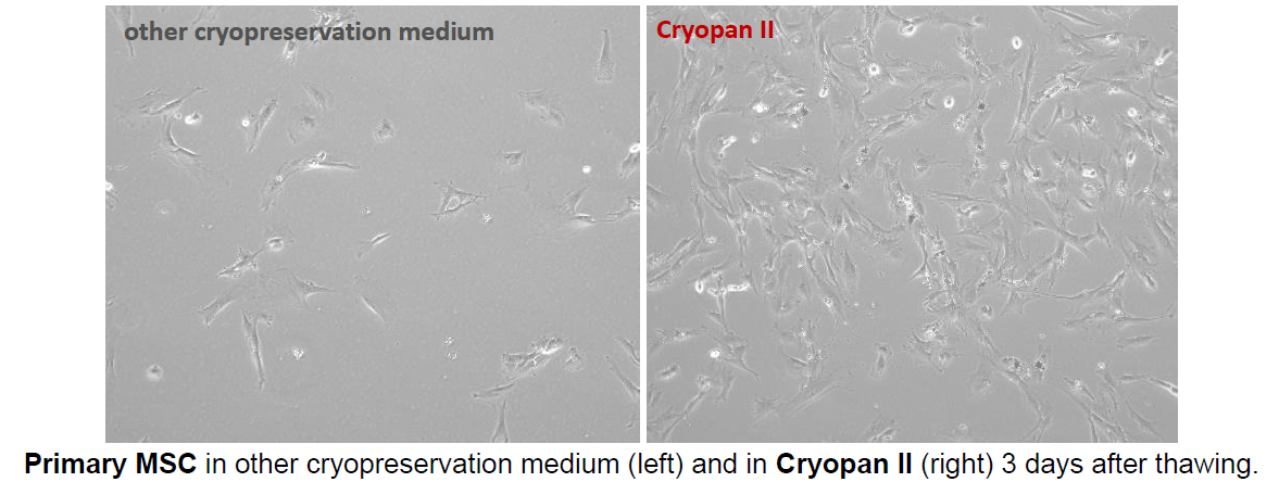 Compaing primary MSC in other cryopreservation medium (left) and in Cryopan II (right) 3 days after thawing.