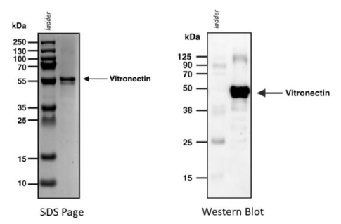 Figure 1: SDS Page and Western Blot showing the purified Multus Vitronectin.