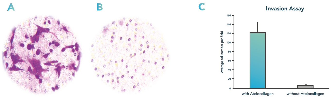 Promed Bioscience Atelocollagen used as chemoattractant in cell invasion assay