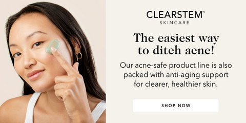 Non comedogenic acne products