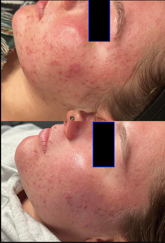 WISH Skin Health before and after