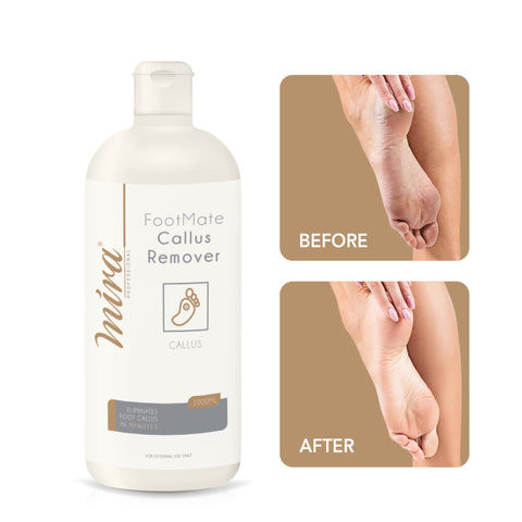 Mira FootMate Callus Remover 1000ml - Albasel cosmetics