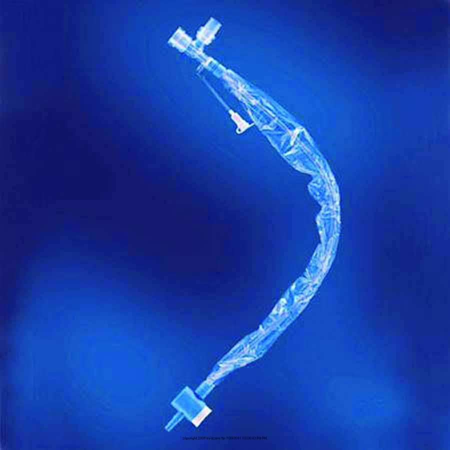 Trach Elbow Suction Catheter - Kimberly Clark-Ballard